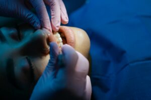 Cientistas testam medicamento que faz dente nascer de novo